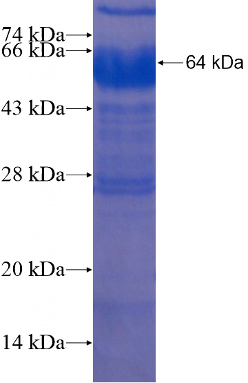 Recombinant Human ACRC SDS-PAGE