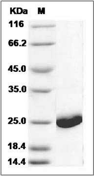 Human TNFAIP8 Protein (His Tag) SDS-PAGE