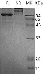 Human HK3 (His tag) recombinant protein