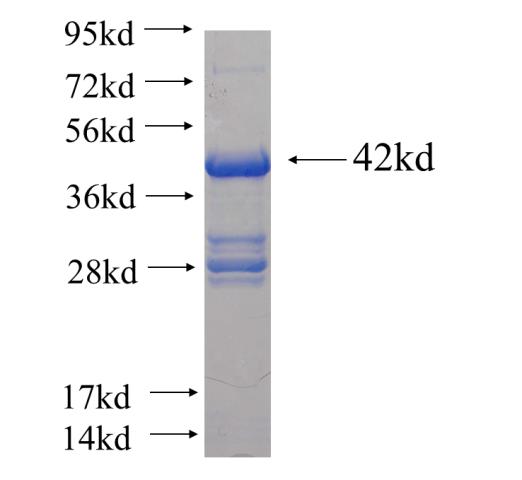 Recombinant human ZSCAN21 SDS-PAGE