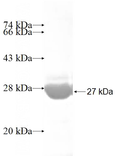 Recombinant Human ERLIN2 SDS-PAGE