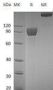 Human ROBO4/UNQ421/PRO3674 (Fc tag) recombinant protein