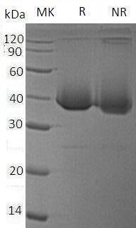 Human KIR2DL3/CD158B2/KIRCL23/NKAT2 (His tag) recombinant protein