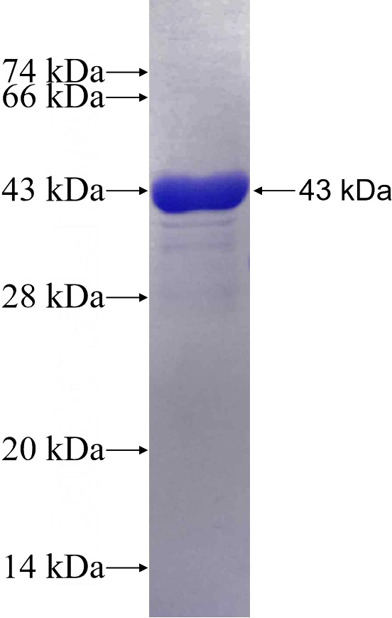 Recombinant Human TICAM1 SDS-PAGE
