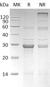 Human SERPINB5/PI5 recombinant protein
