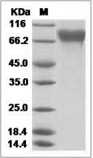 Influenza A H3N2 (A/Babol/36/2005) Hemagglutinin / HA Protein (His Tag)