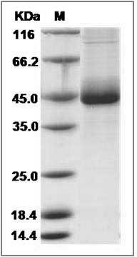 Canine IL3RA Protein (His Tag) SDS-PAGE