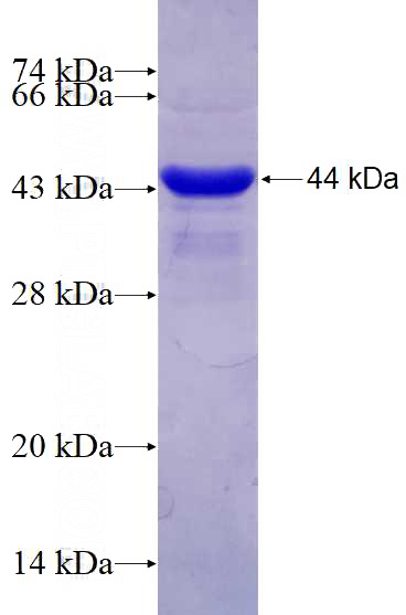 Recombinant Human UBL4A SDS-PAGE