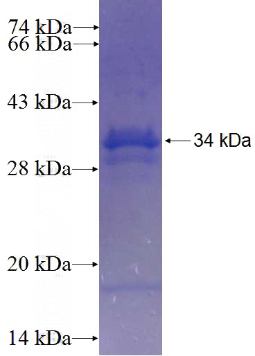 Recombinant Human C9orf116 SDS-PAGE