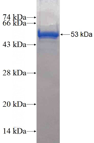Human CCDC85B Recombinant protein (GST tag)