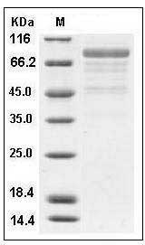 Human Cadherin-12 / CDH12 Protein (His Tag) SDS-PAGE