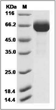 Influenza A H7N9 (A/Hangzhou/1/2013) Hemagglutinin / HA Protein (His Tag) SDS-PAGE