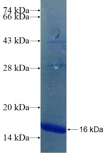 Recombinant Human ACC SDS-PAGE