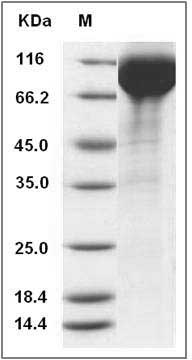 Human SIGLEC5 Protein (Fc Tag) SDS-PAGE