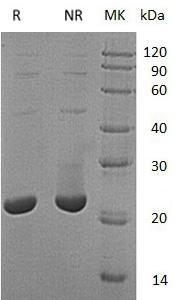 Human TMX2/TXNDC14/CGI-31 (His tag) recombinant protein