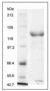 Rhesus HER3 / ErbB3 Protein (Fc Tag) SDS-PAGE