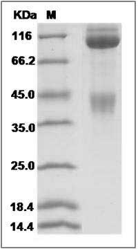 Cynomolgus / Rhesus c-MET / HGFR Protein (Fc Tag) SDS-PAGE