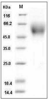 Human DR6 / TNFRSF21 Protein (His Tag) SDS-PAGE