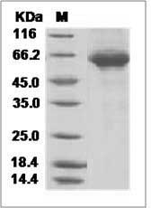 Influenza A H18N11 (A/flat-faced bat/Peru/033/2010) Hemagglutinin / HA Protein (His Tag)