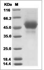 Influenza A H5N8 (A/Ch/Netherlands/14015526/2014) Hemagglutinin / HA1 Protein (His Tag) 