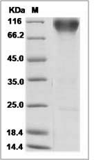 Human FGFR2 / CD332 Protein (alpha(IIIb), Fc Tag)