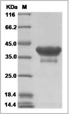 Rat CD81 / TAPA-1 Protein (Fc Tag)