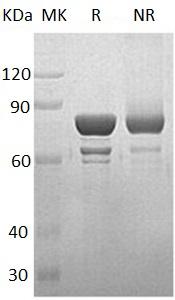 Human STAT1 recombinant protein