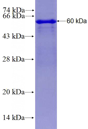 Recombinant Human C17orf71 SDS-PAGE