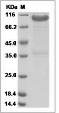 Human LRRC15 Protein (Fc Tag)