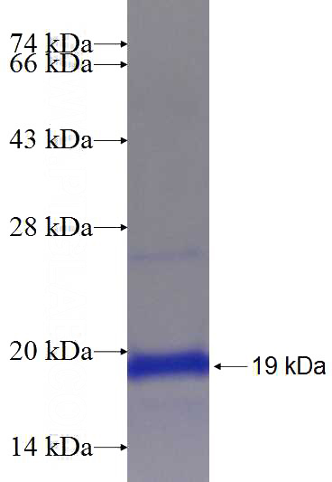 Recombinant Human FAM20A SDS-PAGE