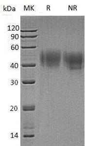 Human IFNAR2/IFNABR/IFNARB (His tag) recombinant protein