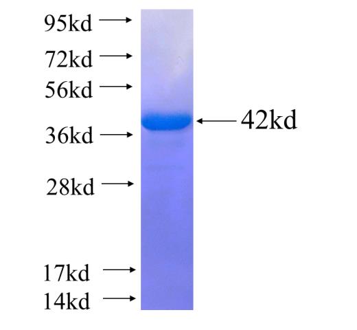 Recombinant human RNF41(Full length) SDS-PAGE