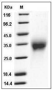 Mouse ACVR2A / ActrIIa Protein (His Tag) SDS-PAGE