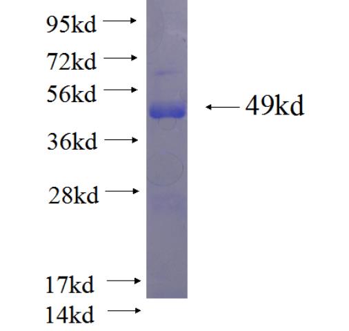 Recombinant human EIF3M SDS-PAGE