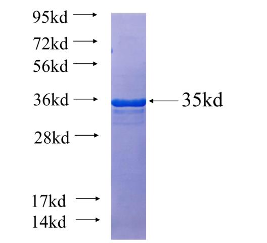 Recombinant human FAM76A SDS-PAGE
