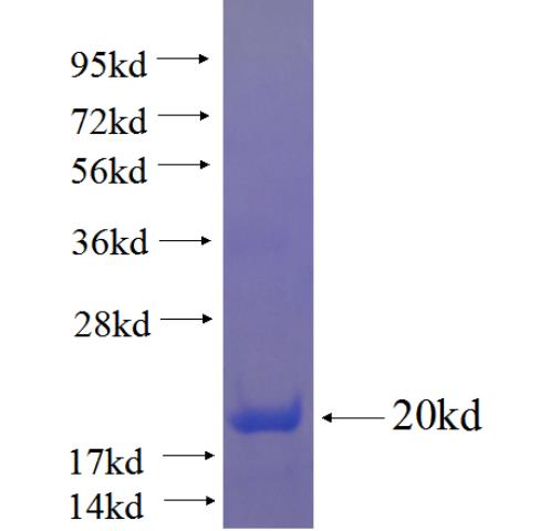 Recombinant human RNF144A SDS-PAGE