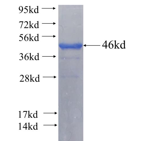 Recombinant human C2orf27B SDS-PAGE