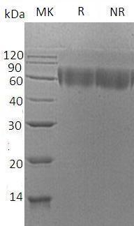 Human TNFRSF21/DR6/UNQ437/PRO868 (His tag) recombinant protein