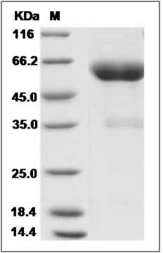 Canine Ephrin-B2 / EFNB2 Protein (Fc Tag) SDS-PAGE