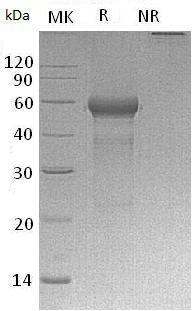 Human TNFRSF25/APO3/DDR3 (Fc tag) recombinant protein