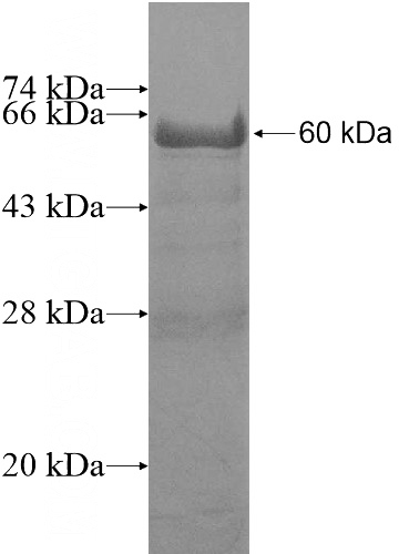 Recombinant Human NOL11 SDS-PAGE