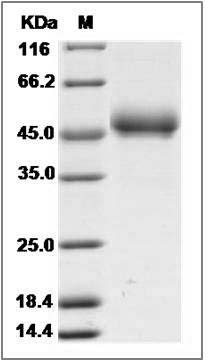 Human FAM171B / KIAA1946 Protein (His Tag) SDS-PAGE