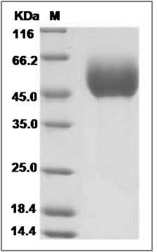 Canine IL17RD Protein (His Tag) SDS-PAGE