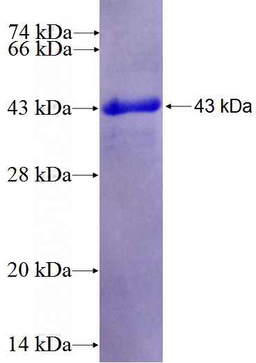 Recombinant Human FAM84A SDS-PAGE