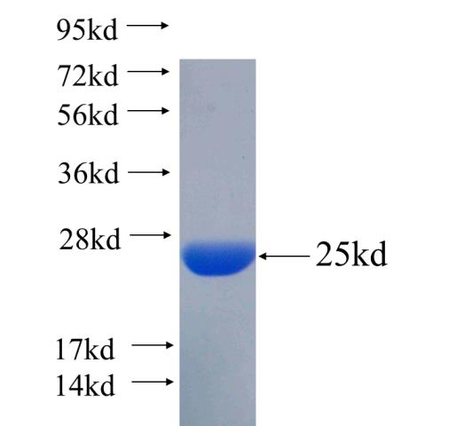 Recombinant human PPM1D SDS-PAGE