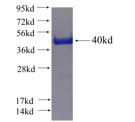Recombinant human ZFYVE28 SDS-PAGE