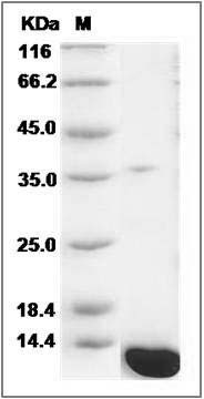 Mouse S100A8 / CAGA Protein (His Tag) SDS-PAGE