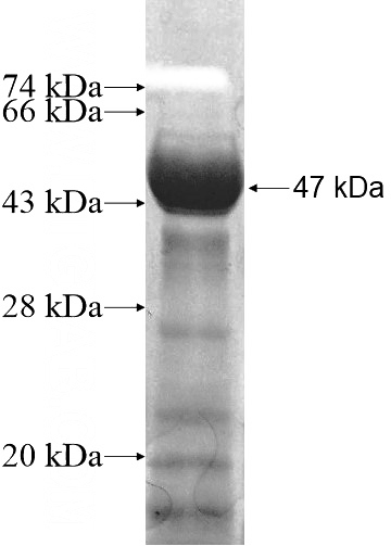 Recombinant Human RAB11FIP2 SDS-PAGE