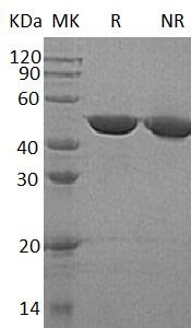 Human GALK2/GK2 (His tag) recombinant protein