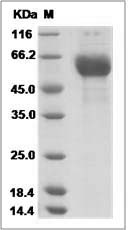 Influenza A H3N2 (A/Netherlands/178/1995(RG145K)) Hemagglutinin / HA1 Protein (His Tag)